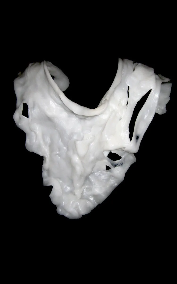 Deformed Collarbone